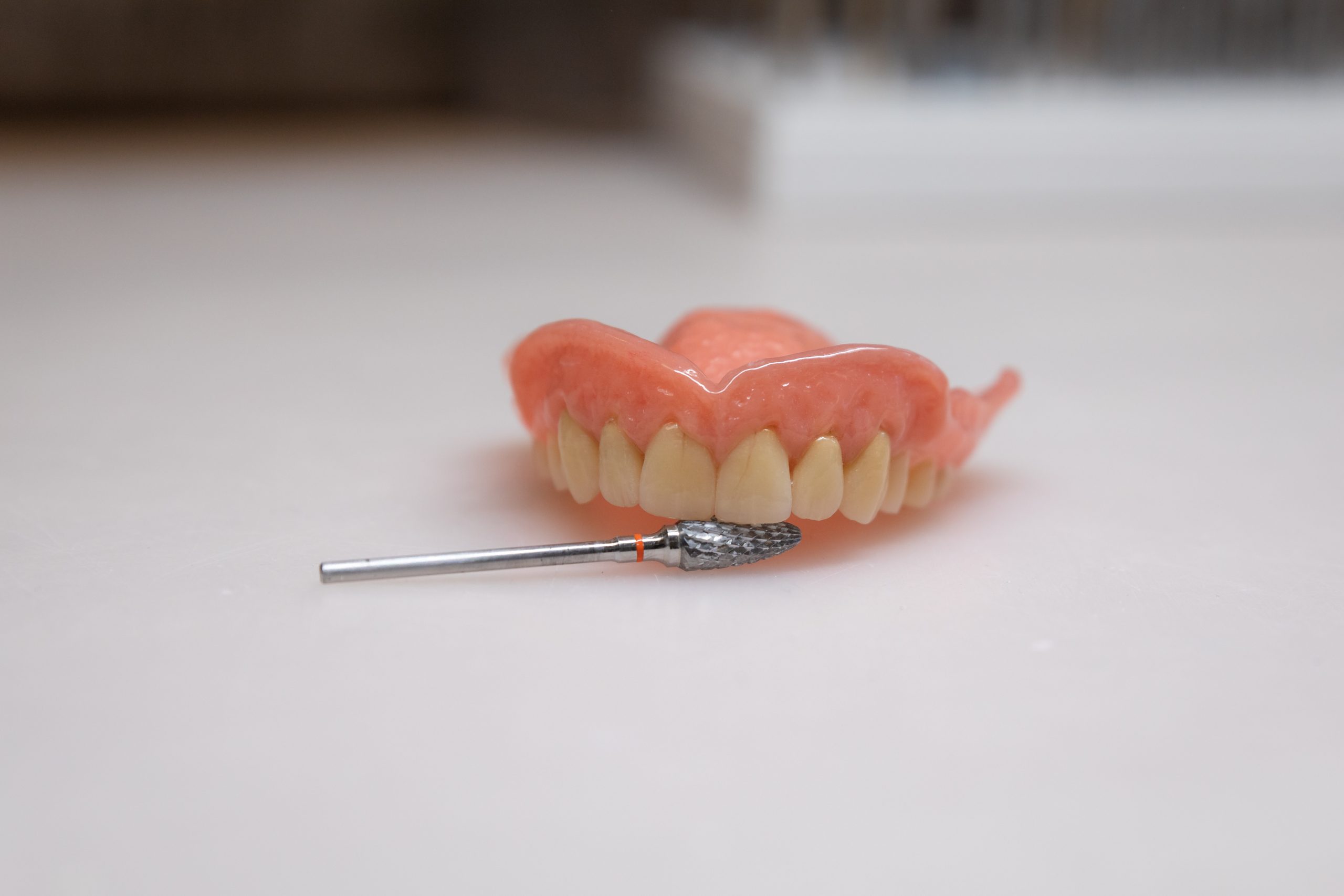 Zahnprothese Oberkiefer – moderner Zahnersatz aus dem Dentallabor